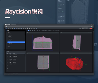 銳視醫(yī)療CT分析軟件界?設計